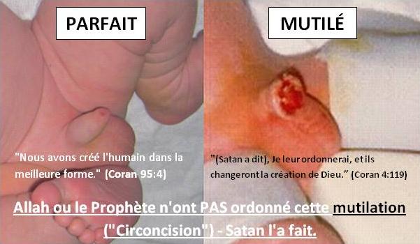 pourquoi la circoncision dans l'islam