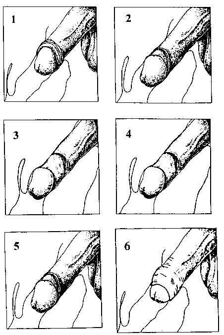 Action de glissement durant la pénétration vaginale