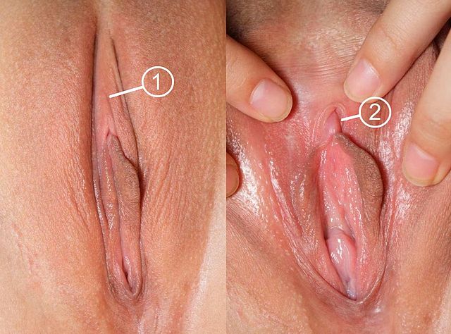 Prépuce clitoridien ou capuchon du clitoris