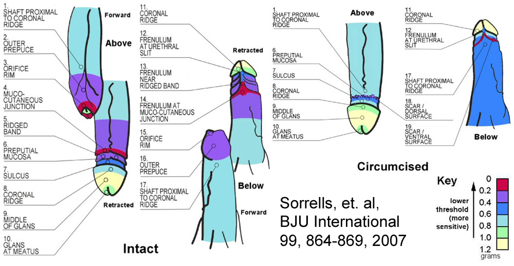 Etude de Sorrells sur la sensibilité du prépuce 2007