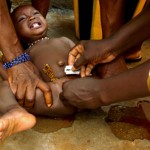 Excision en Afrique
