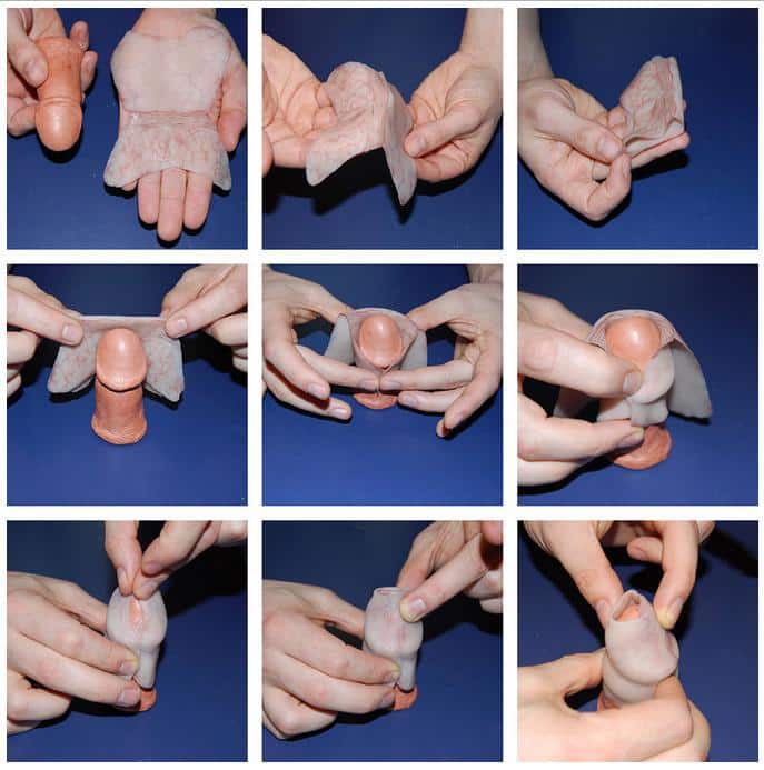 photos pliage prepuce penis