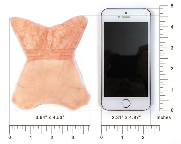 comparaison surface prepuce deplie avec telephone portable